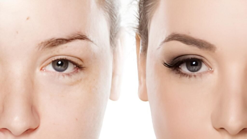Cejas Mejoradas antes y despues Resultados de microblading
